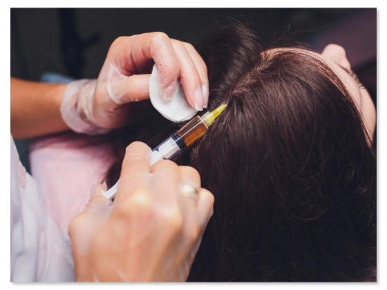 prp-treatments-Banjara Hills, Hyderabad